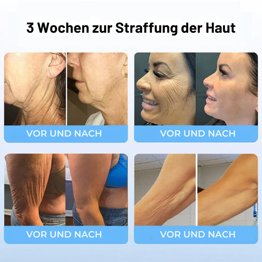 CollagenFirm™ | 1+1 GRATIS!