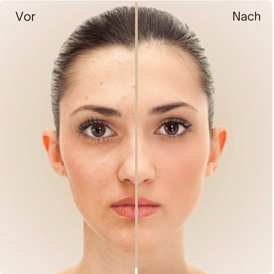 FlawlessGlow™ | Unvollkommenheiten mühelos kaschieren