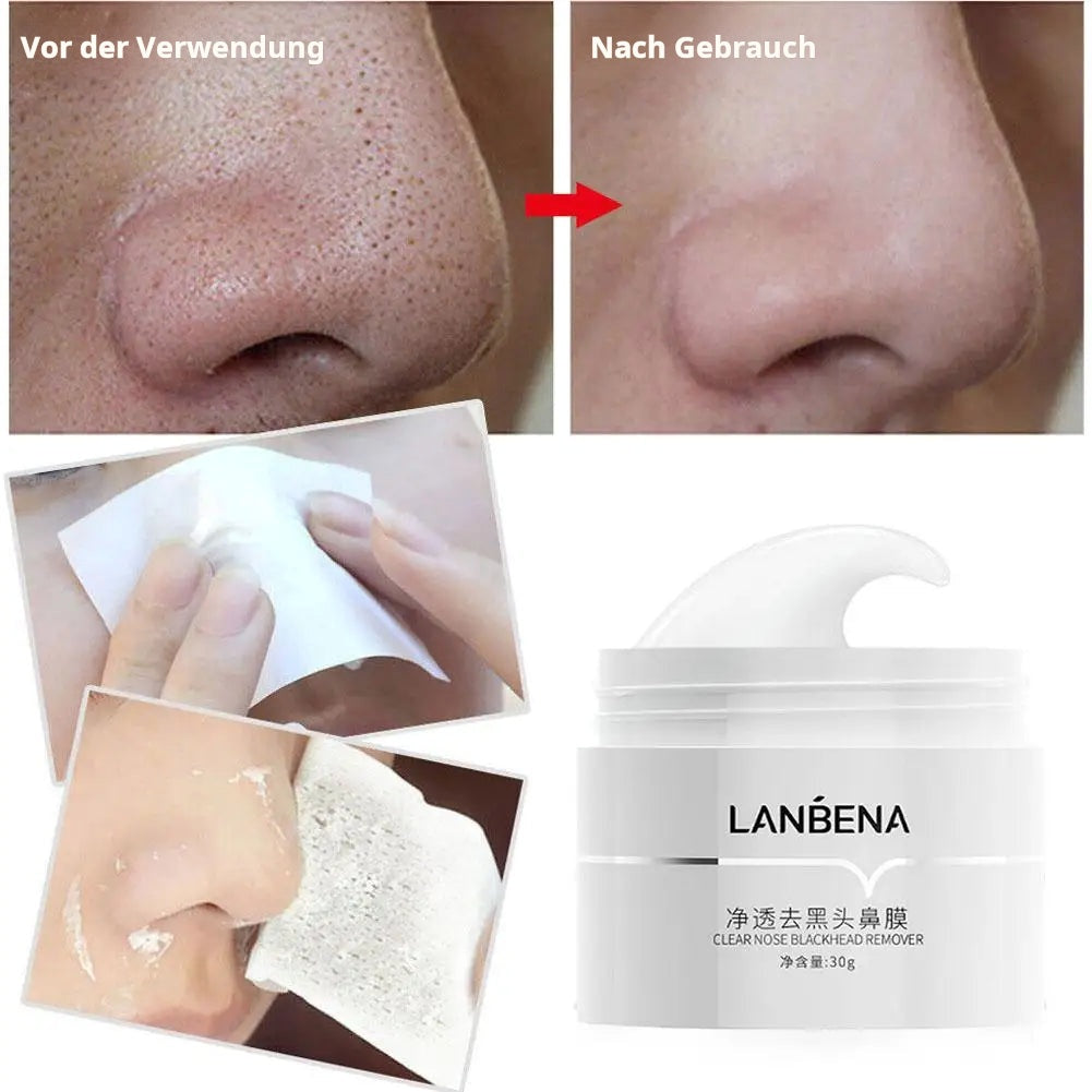 Blackhead Exklusiv™ Gesichtscreme