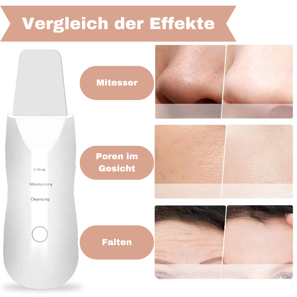 ClearPulse™ Mitesserentferner | Die Lösung für unerwünschte Mitesser