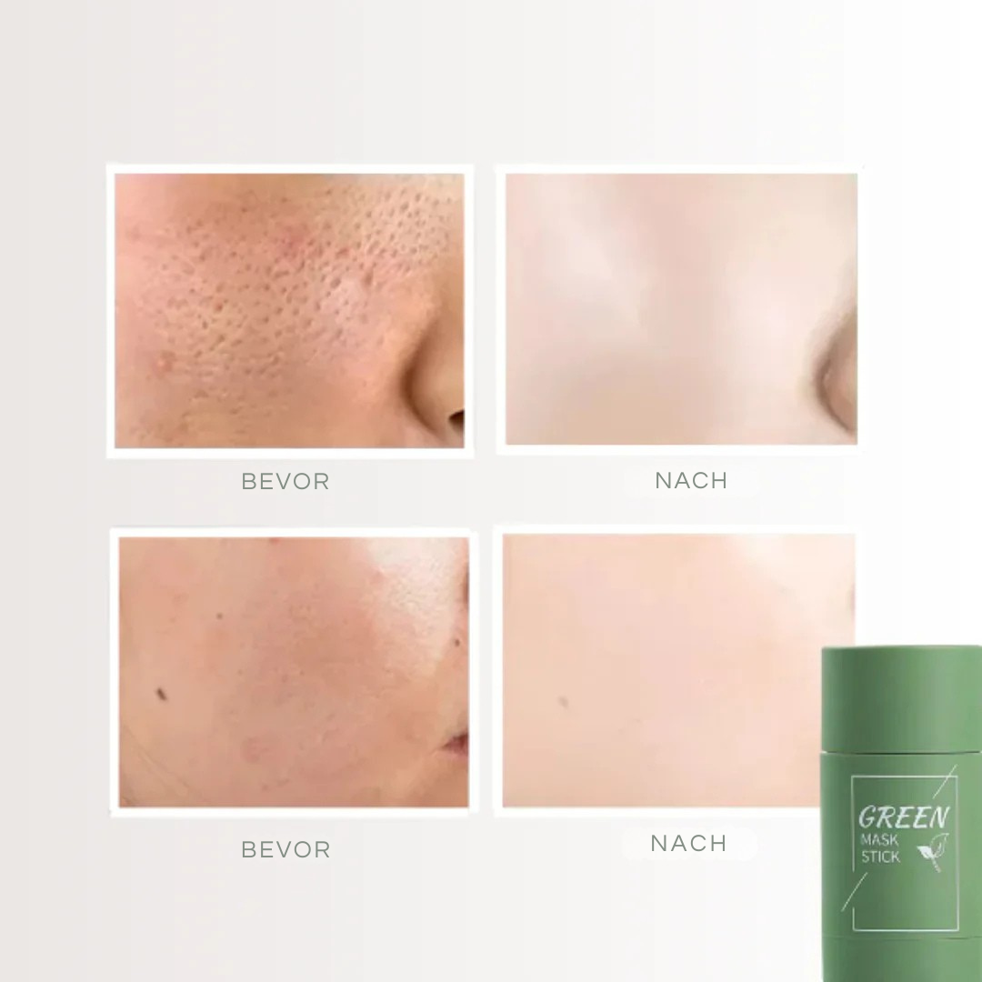 CleanMask™ | Hautporen effektiv reinigen