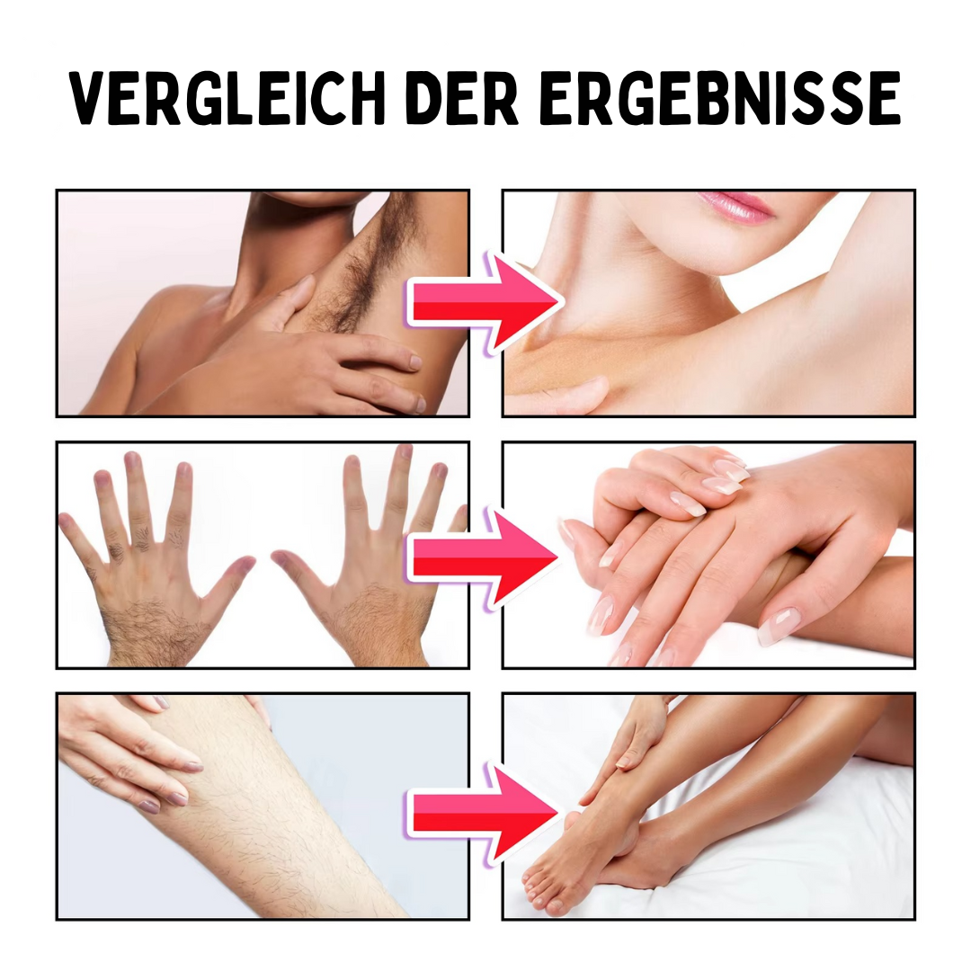 HairFree™ | 1+1 GRATIS!